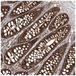 UBXN4, Rabbit, Polyclonal Antibody, Abnova 100&mu;L; Unlabeled:Antibodies,