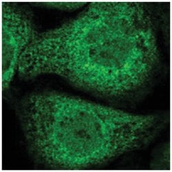UBXN4, Rabbit, Polyclonal Antibody, Abnova 100&mu;L; Unlabeled:Antibodies,