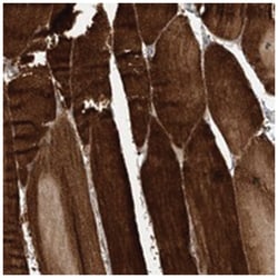 TTC26 Rabbit anti-Human, Polyclonal Antibody, Abnova 100&mu;L; Unlabeled:Antibodies,