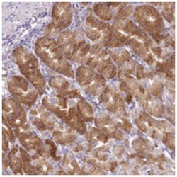 KIAA1244, Rabbit, Polyclonal Antibody, Abnova 100&mu;L; Unlabeled:Antibodies,