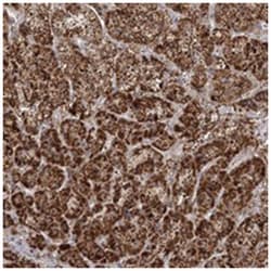 LACTB Rabbit anti-Human, Polyclonal Antibody, Abnova 100 &mu;L | Buy Online | Abnova Corporation | Fisher Scientific