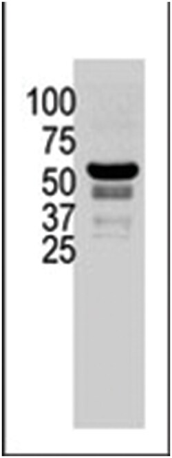 PAK2 Rabbit anti-Human, Polyclonal Antibody, Abnova 400 &mu;L | Buy Online | Abnova | Fisher Scientific