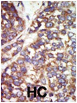 PAK2 Rabbit anti-Human, Polyclonal Antibody, Abnova 400 &mu;L | Buy Online | Abnova | Fisher Scientific