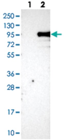 KIAA1586, Rabbit, Polyclonal Antibody, Abnova 100&mu;L; Unlabeled:Antibodies,