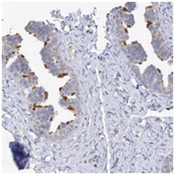 DNAH6, Rabbit, Polyclonal Antibody, Abnova 100&mu;L; Unlabeled:Antibodies,