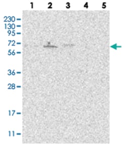 OBSL1, Rabbit, Polyclonal Antibody, Abnova 100 &mu;L | Buy Online | Abnova Corporation | Fisher Scientific