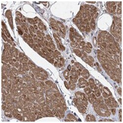OBSL1, Rabbit, Polyclonal Antibody, Abnova 100 &mu;L | Buy Online | Abnova Corporation | Fisher Scientific