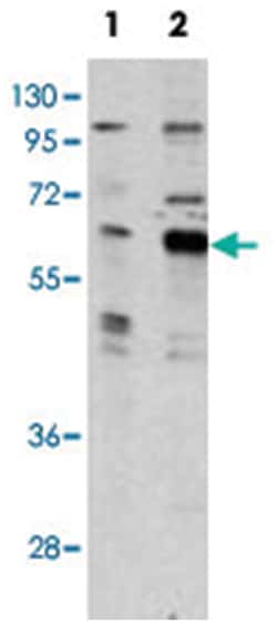 PAK3, Rabbit, Polyclonal Antibody, Abnova 400&mu;L; Unlabeled:Antibodies,