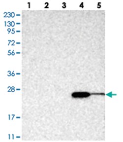 ABHD14B Rabbit anti-Human, Polyclonal Antibody, Abnova 100 &mu;L | Buy Online | Abnova Corporation | Fisher Scientific