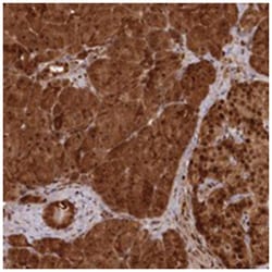 ABHD14B Rabbit anti-Human, Polyclonal Antibody, Abnova 100 &mu;L | Buy Online | Abnova Corporation | Fisher Scientific