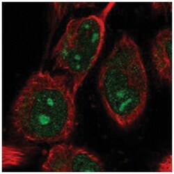 ABHD14B Rabbit anti-Human, Polyclonal Antibody, Abnova 100 &mu;L | Buy Online | Abnova Corporation | Fisher Scientific