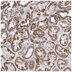 SPATA5, Rabbit, Polyclonal Antibody, Abnova 100 &mu;L | Buy Online | Abnova Corporation | Fisher Scientific