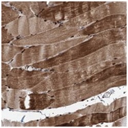 FAM53A, Rabbit, Polyclonal Antibody, Abnova 100 &mu;L | Buy Online | Abnova Corporation | Fisher Scientific
