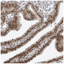 YTHDC1, Rabbit, Polyclonal Antibody, Abnova 100&mu;L; Unlabeled:Antibodies,