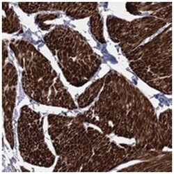 ARSJ, Rabbit, Polyclonal Antibody, Abnova 100 &mu;L | Buy Online | Abnova Corporation | Fisher Scientific