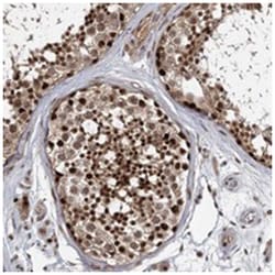 DCUN1D4 Rabbit anti-Human, Mouse, Rat, Polyclonal Antibody, Abnova 100 &mu;L | Buy Online | Abnova Corporation | Fisher Scientific