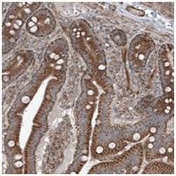KY, Rabbit, Polyclonal Antibody, Abnova 100 &mu;L | Buy Online | Abnova Corporation | Fisher Scientific