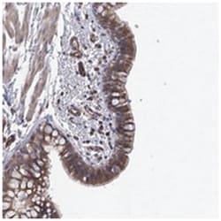 RWDD4A, Rabbit, Polyclonal Antibody, Abnova 100 &mu;L | Buy Online | Abnova Corporation | Fisher Scientific