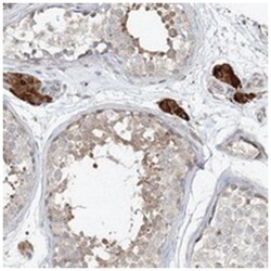 CXXC5 Rabbit anti-Human, Polyclonal Antibody, Abnova 100 &mu;L | Buy Online | Abnova Corporation | Fisher Scientific