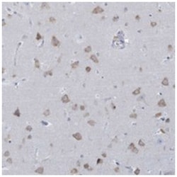 CCNJ, Rabbit, Polyclonal Antibody, Abnova 100 &mu;L | Buy Online | Abnova Corporation | Fisher Scientific