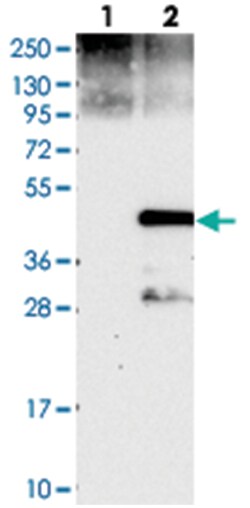 CCNJ, Rabbit, Polyclonal Antibody, Abnova 100 &mu;L | Buy Online | Abnova Corporation | Fisher Scientific