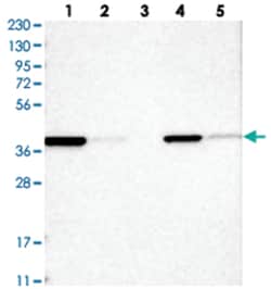HIBCH, Rabbit, Polyclonal Antibody, Abnova 100 &mu;L | Buy Online | Abnova Corporation | Fisher Scientific