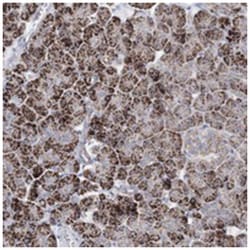 HIBCH, Rabbit, Polyclonal Antibody, Abnova 100 &mu;L | Buy Online | Abnova Corporation | Fisher Scientific