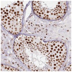 DDX46, Rabbit, Polyclonal Antibody, Abnova 100&mu;L; Unlabeled:Antibodies,