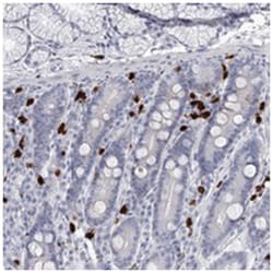 CCDC147, Rabbit, Polyclonal Antibody, Abnova 100&mu;L; Unlabeled:Antibodies,