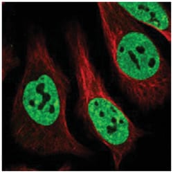 MATR3 Rabbit anti-Human, Polyclonal Antibody, Abnova 100&mu;L; Unlabeled:Antibodies,