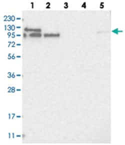 LARP5, Rabbit, Polyclonal Antibody, Abnova 100 &mu;L | Buy Online | Abnova Corporation | Fisher Scientific