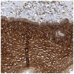LARP5, Rabbit, Polyclonal Antibody, Abnova 100 &mu;L | Buy Online | Abnova Corporation | Fisher Scientific