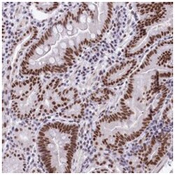 HNRNPA0, Rabbit, Polyclonal Antibody, Abnova 100&mu;L; Unlabeled:Antibodies,