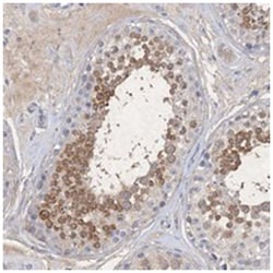 C11orf58, Rabbit, Polyclonal Antibody, Abnova 100 &mu;L | Buy Online | Abnova Corporation | Fisher Scientific