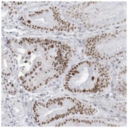 DDX21, Rabbit, Polyclonal Antibody, Abnova 100&mu;L; Unlabeled:Antibodies,