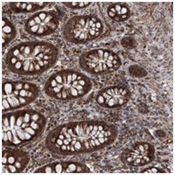 ZNF474, Rabbit, Polyclonal Antibody, Abnova 100 &mu;L | Buy Online | Abnova Corporation | Fisher Scientific