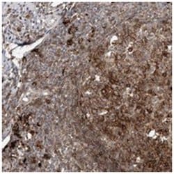 C11orf51, Rabbit, Polyclonal Antibody, Abnova 100&mu;L; Unlabeled:Antibodies,