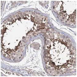 RP11-529I104, Rabbit, Polyclonal Antibody, Abnova 100&mu;L; Unlabeled:Antibodies,