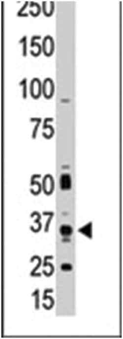 PIM1 Rabbit anti-Human, Polyclonal Antibody, Abnova 400 &mu;L | Buy Online | Abnova Corporation | Fisher Scientific