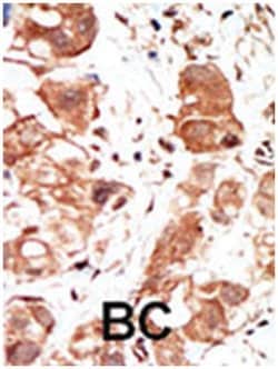 PIM1 Rabbit anti-Human, Polyclonal Antibody, Abnova 400 &mu;L | Buy Online | Abnova Corporation | Fisher Scientific