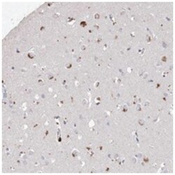 ARSI Rabbit anti-Human, Polyclonal Antibody, Abnova 100&mu;L; Unlabeled:Antibodies,