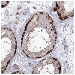 STT3B, Rabbit, Polyclonal Antibody, Abnova 100 &mu;L | Buy Online | Abnova Corporation | Fisher Scientific
