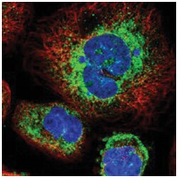 STT3B, Rabbit, Polyclonal Antibody, Abnova 100 &mu;L | Buy Online | Abnova Corporation | Fisher Scientific