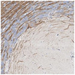 LRP2BP Rabbit anti-Human, Polyclonal Antibody, Abnova 100 &mu;L | Buy Online | Abnova Corporation | Fisher Scientific
