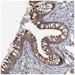 LRP2BP Rabbit anti-Human, Polyclonal Antibody, Abnova 100 &mu;L | Buy Online | Abnova Corporation | Fisher Scientific