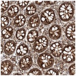 ZNRF3, Rabbit, Polyclonal Antibody, Abnova 100 &mu;L | Buy Online | Abnova Corporation | Fisher Scientific