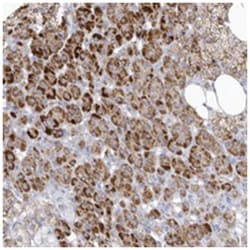 NPAL1, Rabbit, Polyclonal Antibody, Abnova 100 &mu;L | Buy Online | Abnova Corporation | Fisher Scientific