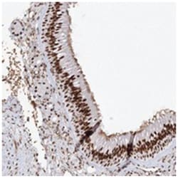 ZNF638 Rabbit anti-Human, Polyclonal Antibody, Abnova 100 &mu;L | Buy Online | Abnova Corporation | Fisher Scientific