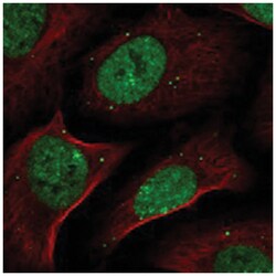 ZNF638 Rabbit anti-Human, Polyclonal Antibody, Abnova 100 &mu;L | Buy Online | Abnova Corporation | Fisher Scientific
