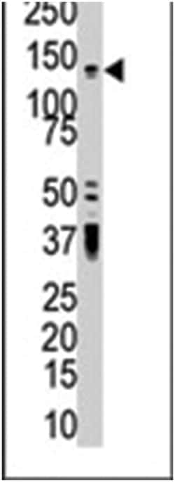 PKD2 Rabbit anti-Human, Polyclonal Antibody, Abnova 400&mu;L; Unlabeled:Antibodies,